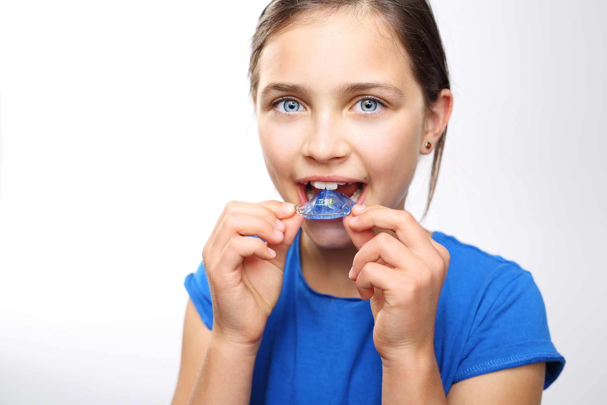 Les appareils orthodontiques pour enfants sont généralement bien tolérés.