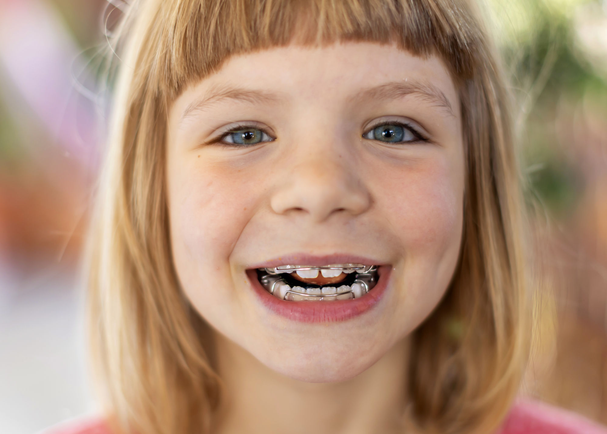En agissant dès l'enfance avec des dispositifs orthodontiques appropriés, il est possible de prévenir l'installation durable des troubles