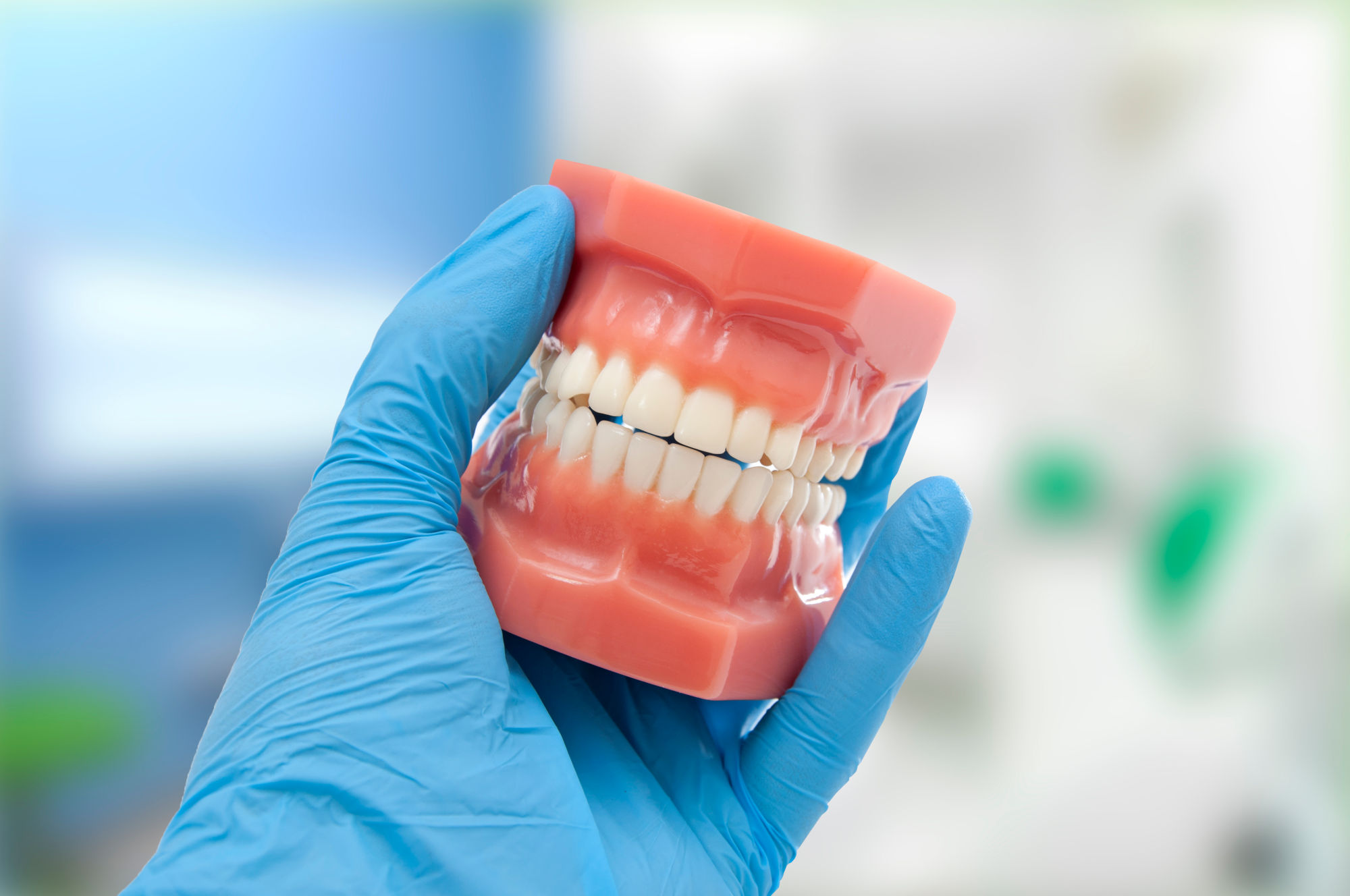 Différents types de malocclusions dentaires : exemples de malpositions et de décalages des mâchoires