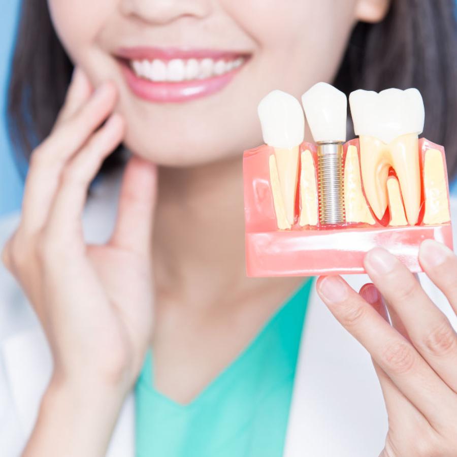 Dent sur pivot : tout savoir sur le pivot dentaire